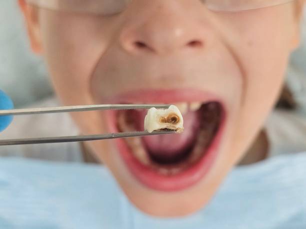 Best Emergency Treatment for Toothache in Elim, PA